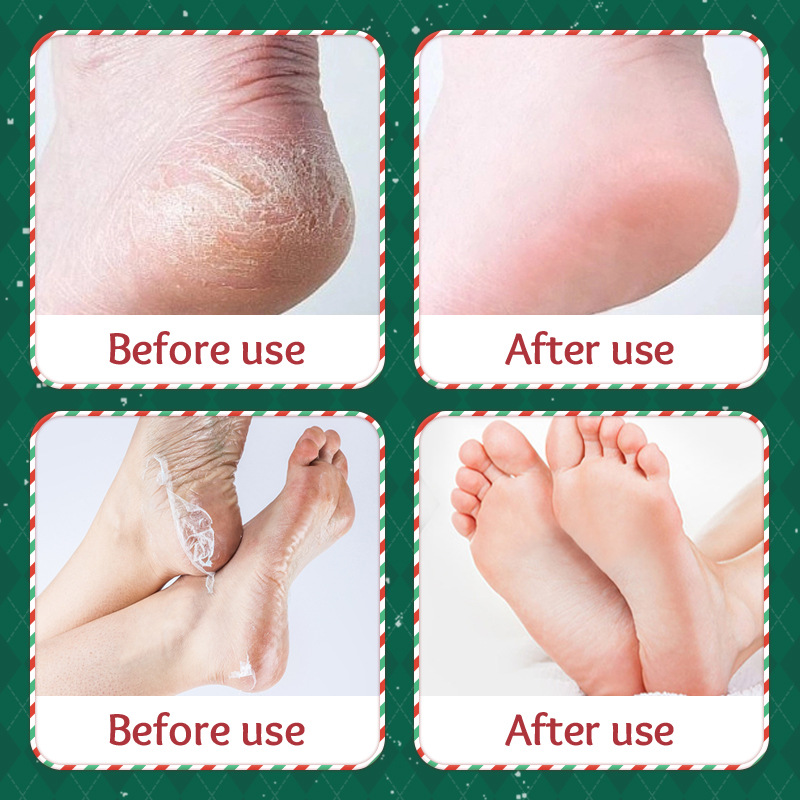 Cross-border wholesale of SADOER Christmas Nicotinamide Nourishing, Smooth and exfoliating foot and hand masks in English Application Scenario