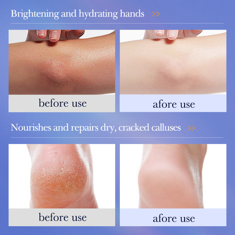 Cross-border export wholesale of SADOER Vaseline Anti-Cracking Nourishing Repair Cream and Hydrating Skin Cream Application Scenario