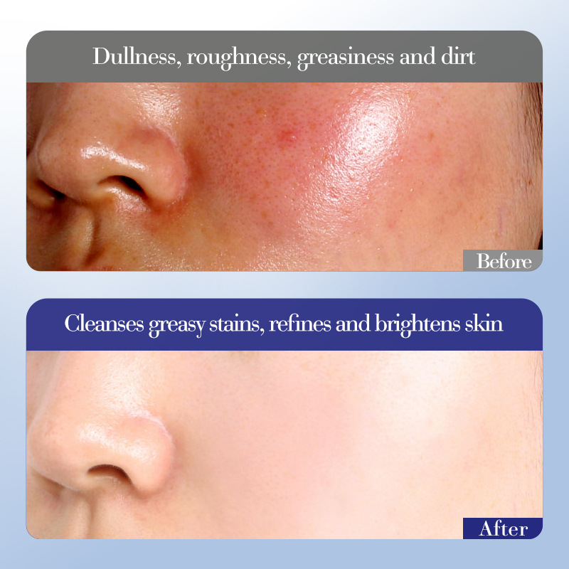 Cross-border export wholesale of SADOER Evening primrose Vitamin E High Moisturizing and Hydrating six-piece set Application Scenario