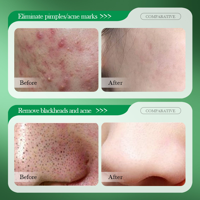 Cross-border wholesale of SADOER salicylic acid acne Cotton Mask for students Specification drawing