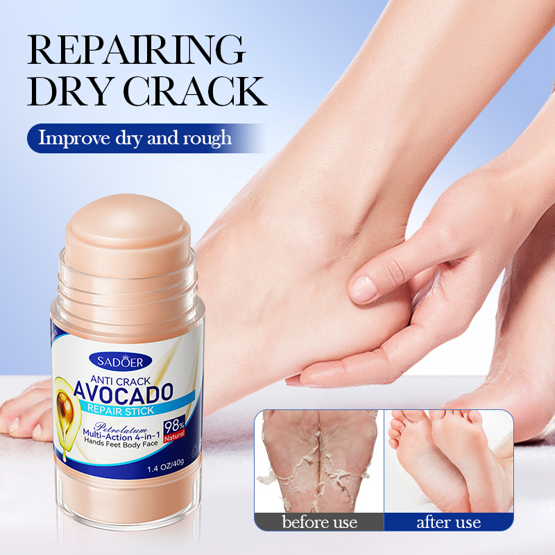 Full English SADOER Anti-Cracking Vaseline Avocado Anti-Cracking Foot Cream Cross-border export wholesale details Picture