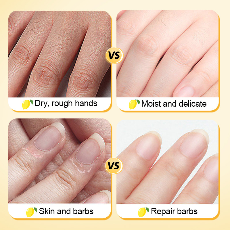 SADOER Lemon Vitamin e Hydrating and Nourishing Hand Cream for skin rejuvenation in autumn and winter cross-border wholesale Application Scenario