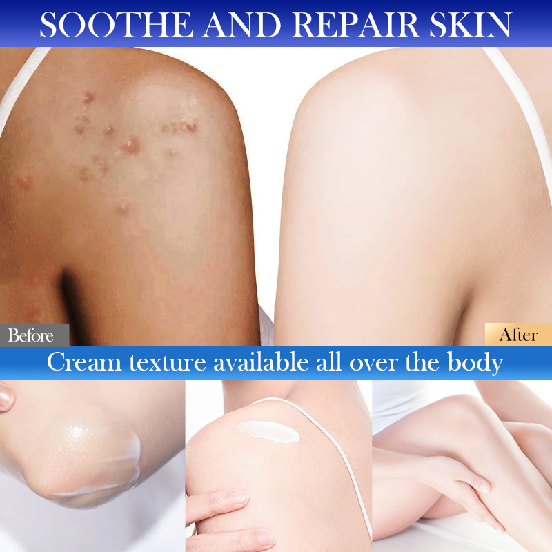 Full English SADOER Type III Collagen Soothing Body Lotion for autumn and winter Moisturizing Body Lotion cross-border export wholesale Application Scenario