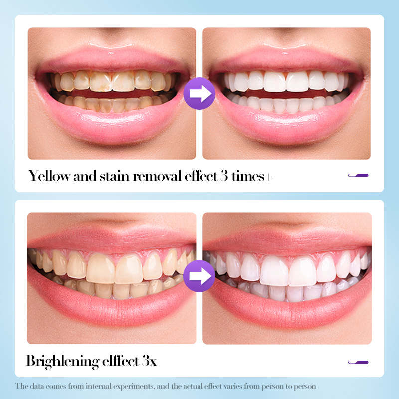 Full English SADOERV34 whitening Tooth powder, deep cleaning and whitening teeth cleaning powder, cross-border export wholesale Item Picture
