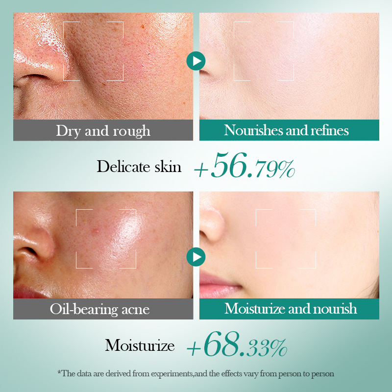 Full English BIOAOUA Boquanya Hyaluronic Acid Moisturizing, Repairing and Firming Skin Care Gift Set Cross-border wholesale Application Scenario