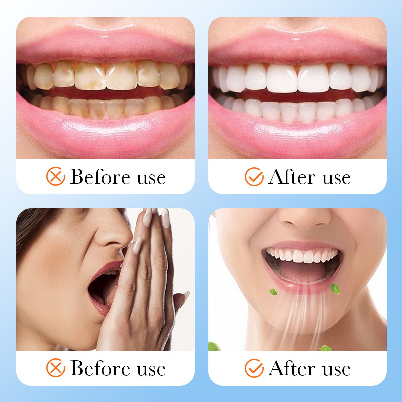 Cross-border wholesale of SADOER vitamin C whitening Tooth powder, teeth cleaning and oral Freshness toothpaste Application Scenario