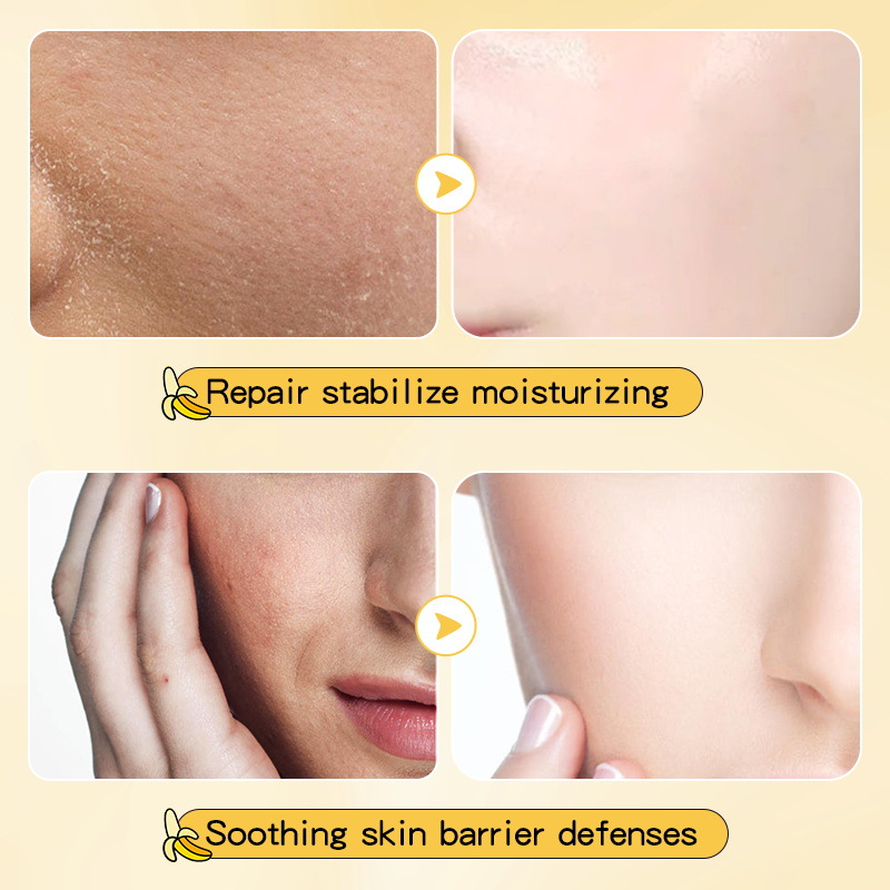 Full English SADOER Banana Skin Rejuvenation Anti-Wrinkle Cream, Moisturizing skin Care Cream, cross-border export wholesale Application Scenario