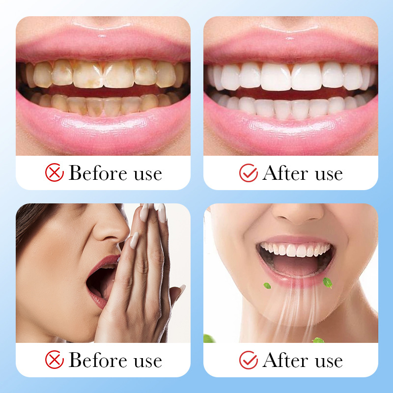 Cross-border export wholesale of SADOER bamboo charcoal activated carbon Teeth whitening Powder and oral toothpaste Application Scenario