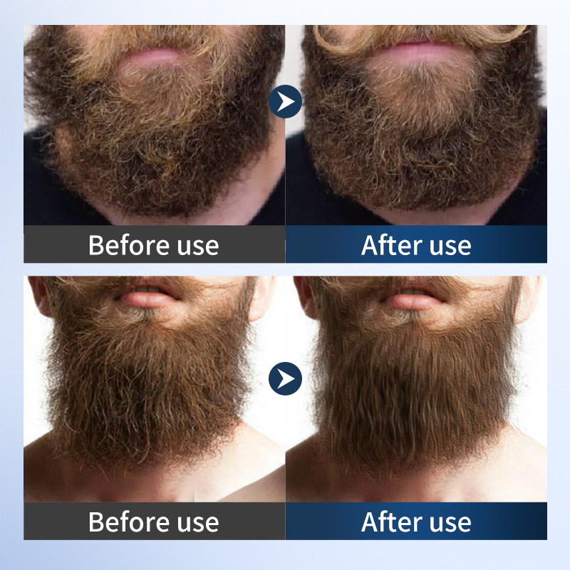 SADOER Beard Smoothing Cream, men's beard Care Moisturizing Beard Cream, cross-border export wholesale Application Scenario