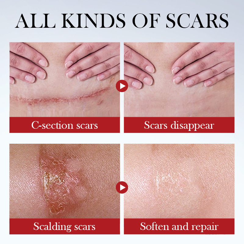 Cross-border wholesale of SADOER scar Repair Cream and Burn Scar Moisturizing Skin cream in English Item Picture
