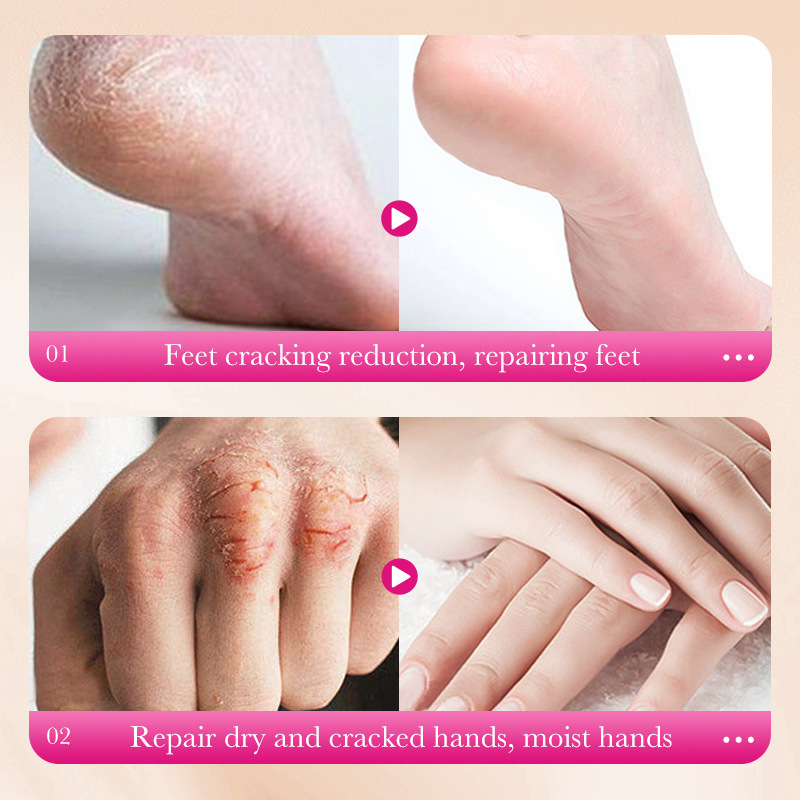 Cross-border export wholesale of SADOER anti-cracking squalane peach foot cream, foot cream and hand cream Item Picture