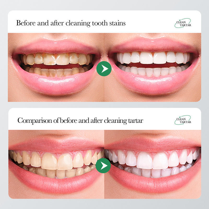All-english BIOAOUA baking Soda Soothing Gum Care Toothpaste, Oral Whitening teeth Gum Care Toothpaste Cross-border wholesale Item Picture