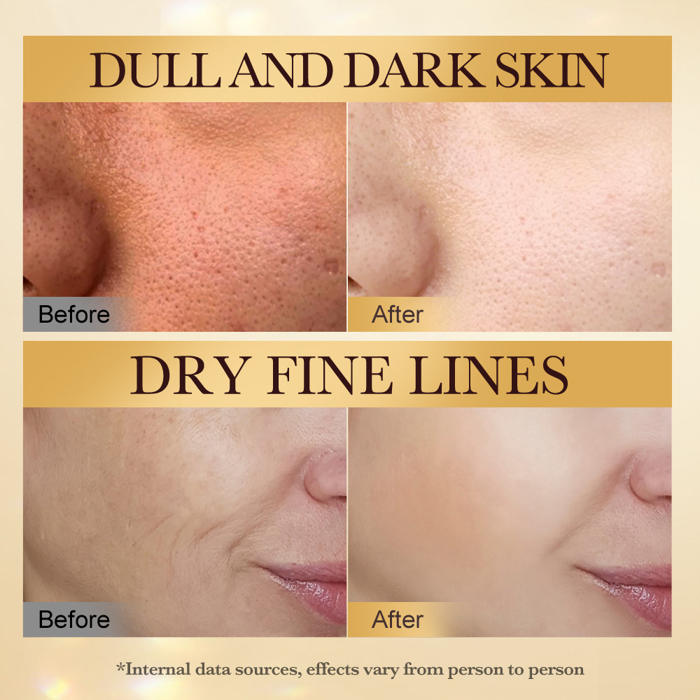 Cross-border export wholesale of SADOER bee Venom anti-wrinkle, Firming and Nourishing six-piece skincare set Item Picture