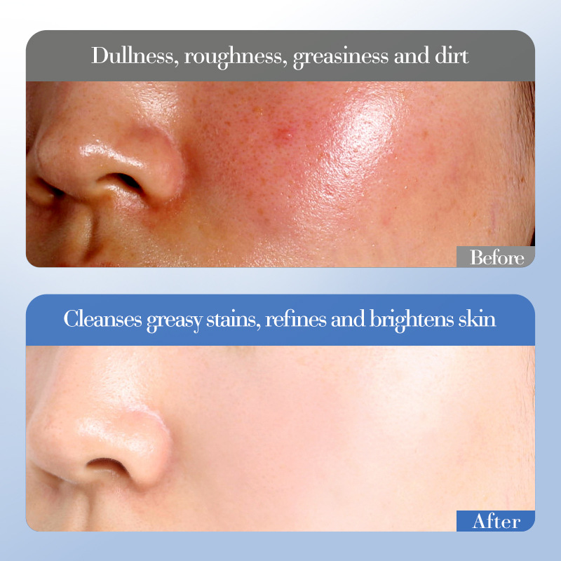 Cross-border wholesale of SADOER White Rice Nicotinamide Brightening Moisturizing Set and Nourishing skin Care products in full English Item Picture