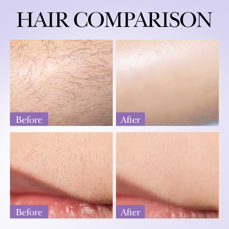 SADOER Hair Growth Inhibition Spray, armpit and leg hair inhibition spray, cross-border export wholesale Application Scenario