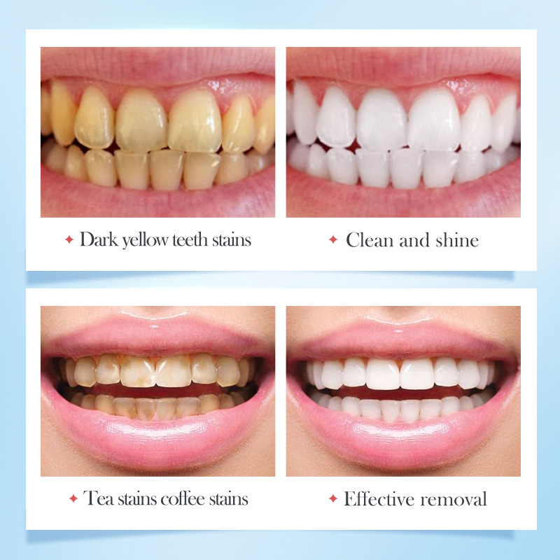 Cross-border wholesale of SADOER Strawberry Probiotic Whitening Toothpaste for Oral whitening, Teeth and gum Protection Application Scenario