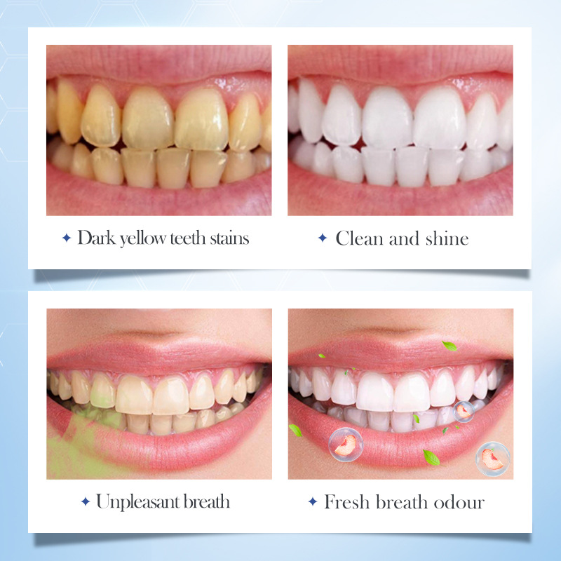 Cross-border wholesale of SADOER peach Whitening and yellowing Solid toothpaste series cleaning toothpaste in English Application Scenario