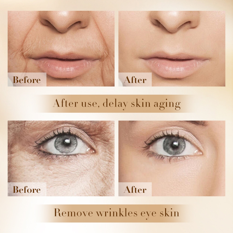 Cross-border wholesale of SADOER Retinol Anti-Wrinkle and Firming Five-piece Moisturizing and rejuvenating skin care set in full English Application Scenario