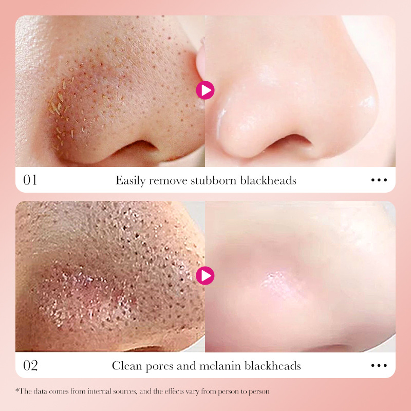 SADOER bamboo Charcoal Deep Cleansing Nose Patches for cleaning the tip of the nose and removing blackheads. Cross-border wholesale of blackhead patches Item Picture