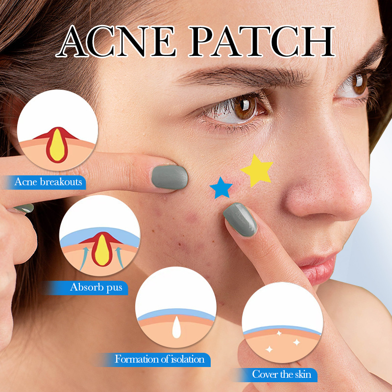 All-english SADOER acne patches, colorful acne patches, student acne patches, cross-border export wholesale details Picture