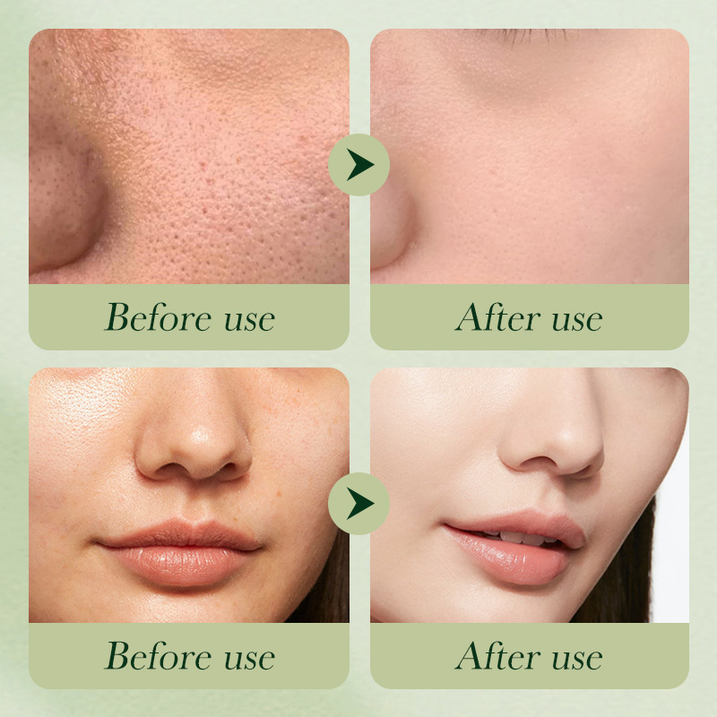 Cross-border wholesale of SADOER avocado Series six-piece set Moisturizing and hydrating skin care products in full English Application Scenario