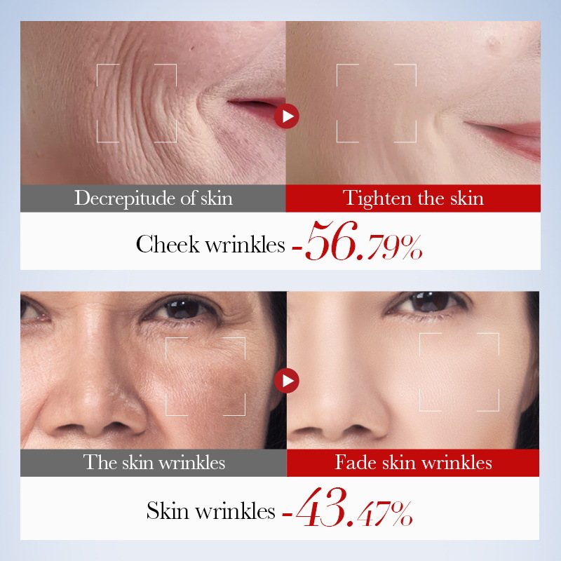 SADOER Snail Collagen Firming and Anti-Wrinkle Series Moisturizing Skin Care Set for cross-border export Application Scenario