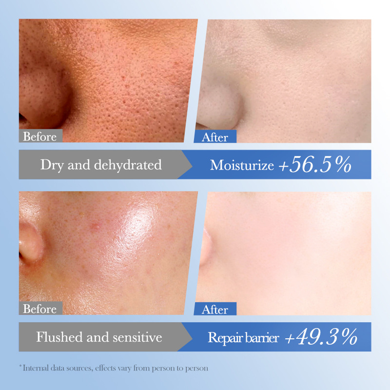 All-english FAYANKOU Hyaluronic Acid Moisturizing Essence, hydrating and skin-nourishing Essence, cross-border export wholesale Application Scenario