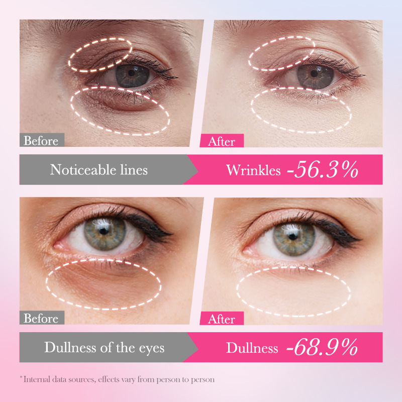 All-english BIOAOUA Mango Anti-Wrinkle Eye Cream, Firming eye bags and fine lines, Moisturizing and Hydrating Eye Cream, cross-border wholesale Item Picture