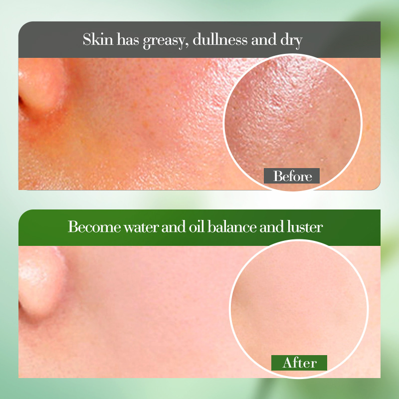 All-english BIOAOUA Aloe Vera Hydrating and Soothing Lotion Moisturizing and Firming Skin Lotion Cross-border export wholesale Item Picture