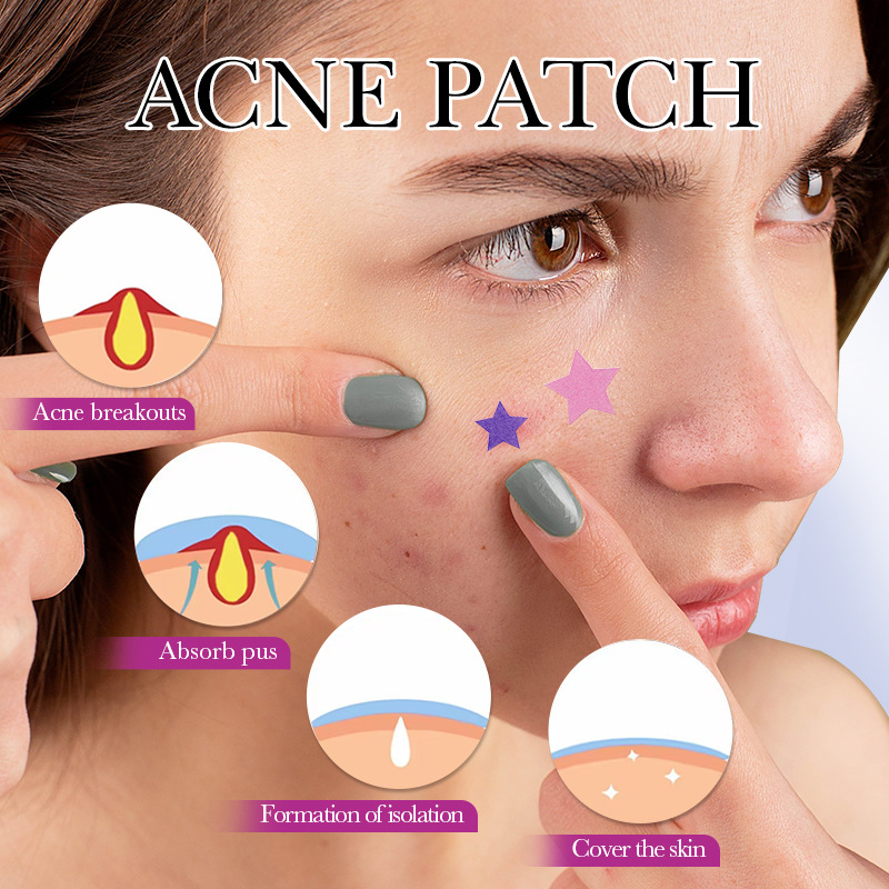 All-english SADOER acne patches, colorful acne patches, students go to acne cross-border foreign trade wholesale details Picture