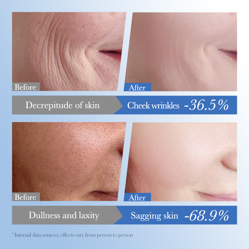 Cross-border export wholesale of SADOER caviar hyaluronic acid Anti-wrinkle Repair Moisturizing Cream and Nourishing Face Cream Application Scenario