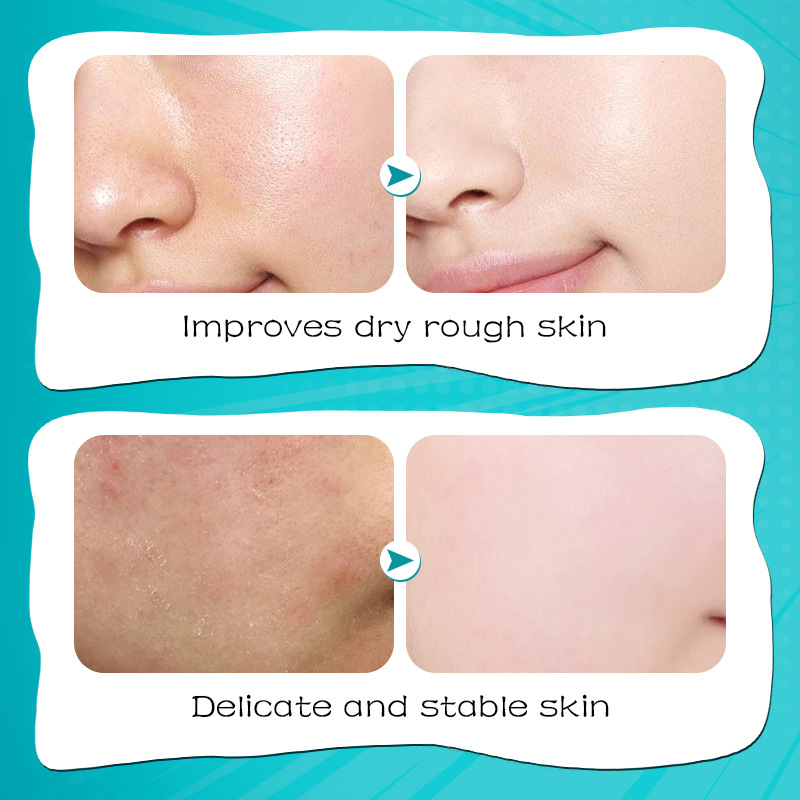 Cross-border export wholesale of all-English SADOER hyaluronic acid Moisturizing and hydrating Facial mask Item Picture