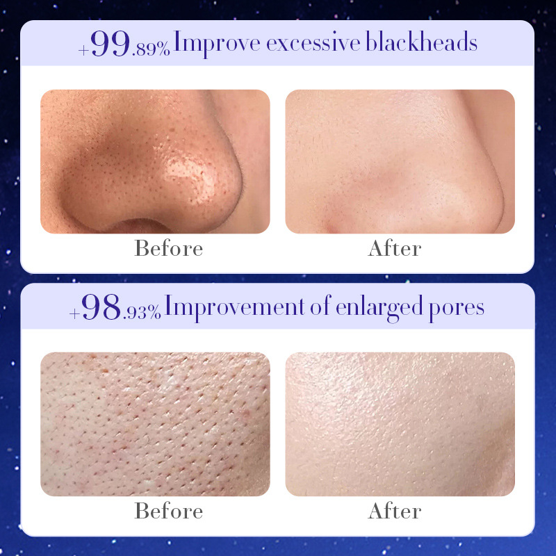 All-english SADOER Moisturizing, Cleansing, Dreamy Starry Sky Peel-off Mask for Blackheads and acne, cross-border export wholesale Item Picture