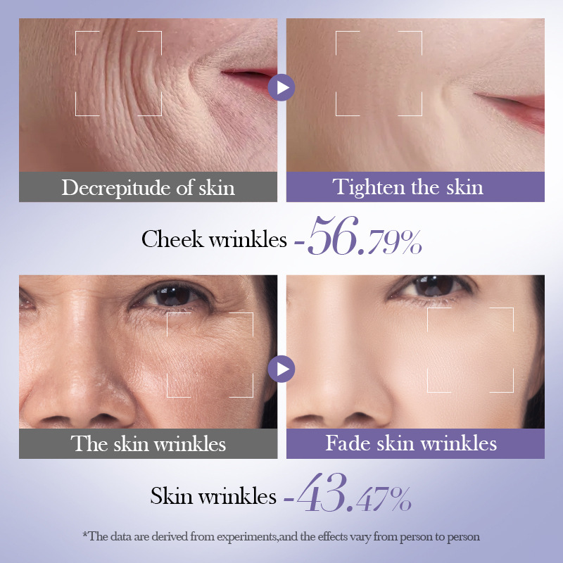 Full English BIOAOUA Retinol Anti-Wrinkle, Firming and High Moisture Retention Set Cross-border export wholesale Item Picture