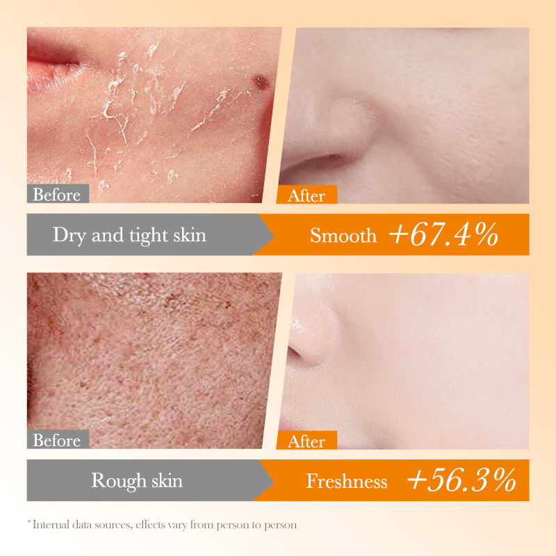 Cross-border wholesale of all-English BIOAOUA Vitamin C Antioxidant Whitening Mask, Brightening and Moisturizing Mask Application Scenario