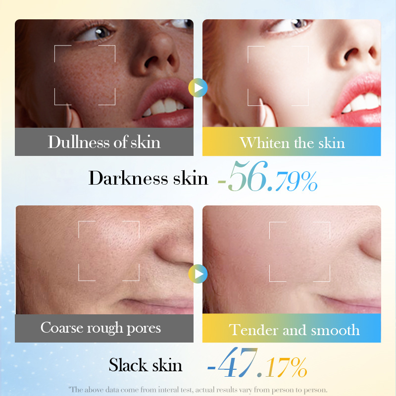 Full English SADOER Turmeric VC Whitening and Brightening Cream, Moisturizing and Hydrating Cream, cross-border export wholesale Item Picture