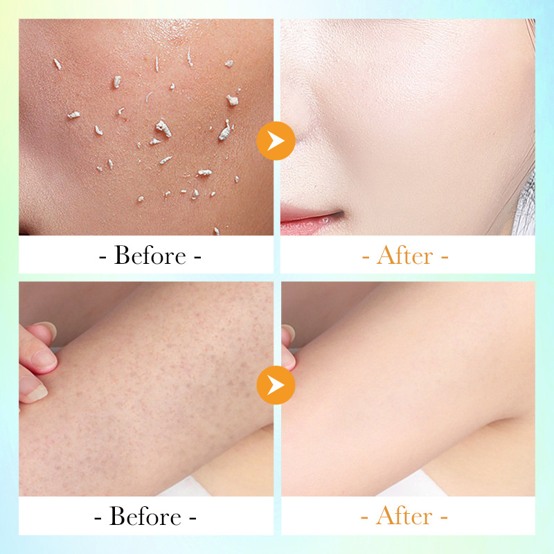 All-english SADOER gentle exfoliating spray for exfoliation and body cleansing cross-border export wholesale Item Picture