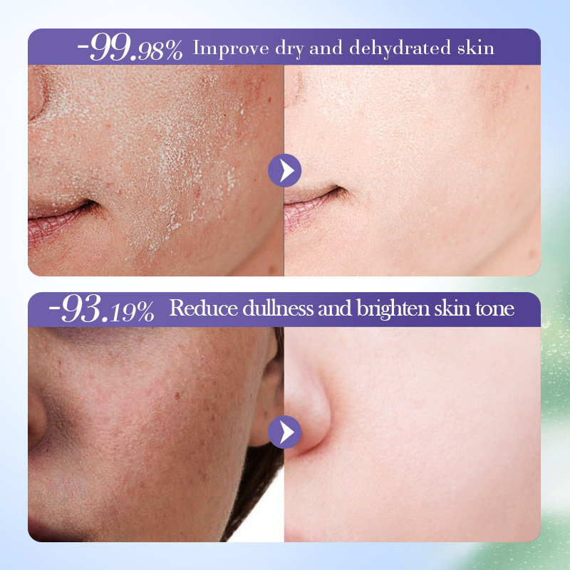 Cross-border export wholesale of SADOER blueberry Hyaluronic Acid Moisturizing Antioxidant Toner Item Picture