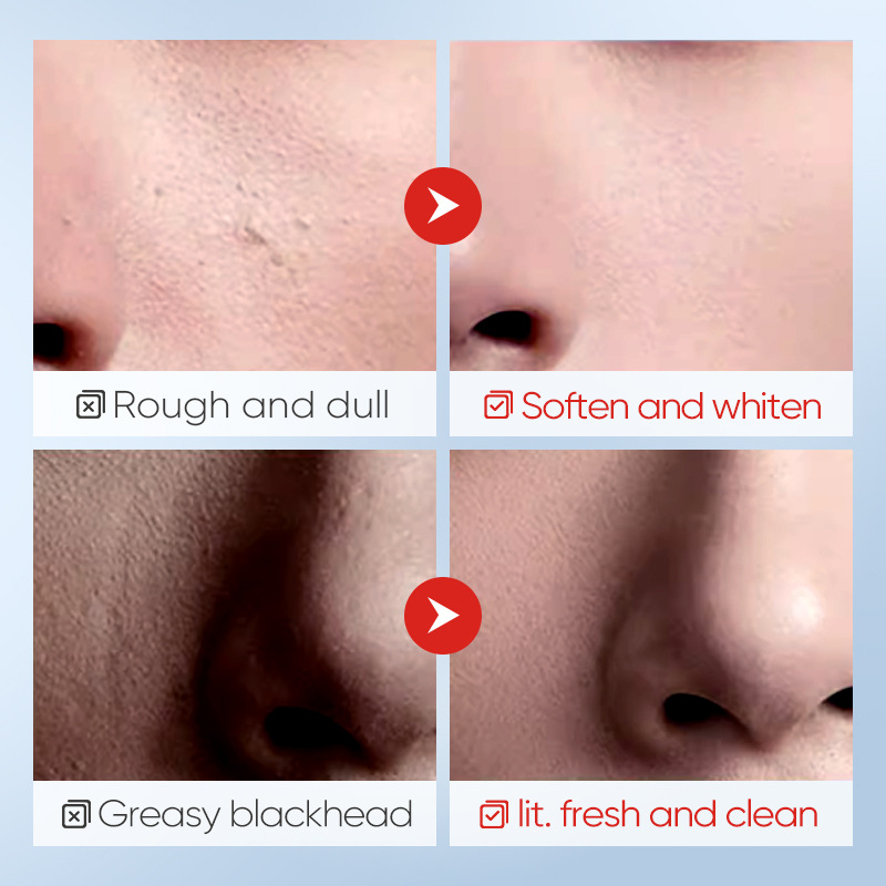 All-english BIOAOUA Men's Oil-Control Moisturizing Facial Cleanser and facial cleanser cross-border export wholesale Application Scenario