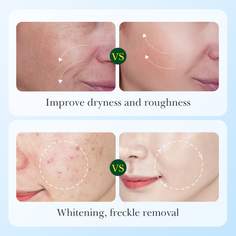 Cross-border export wholesale of SADOER licorice VC Hydrating, Whitening and Nourishing six-piece skin care Set Specification drawing