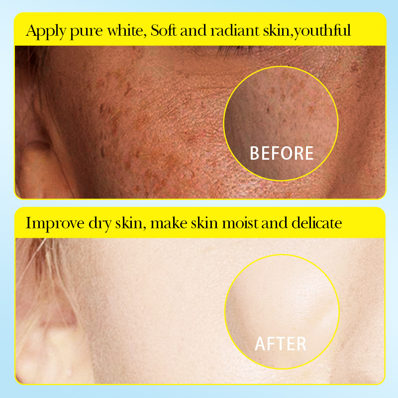 All-english SADOER Lemon Whitening, Hydrating and Nourishing Mask Cross-border export wholesale Item Picture