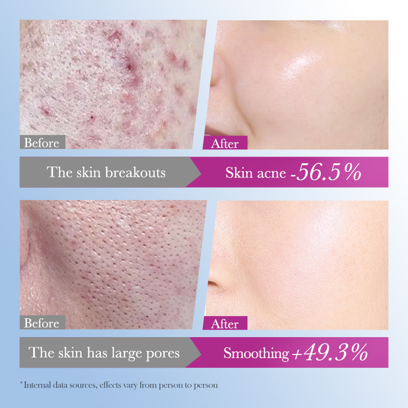 FAYANKOU Salicylic acid Acne Serum and Hydrating Skin Serum Cross-border export wholesale Specification drawing
