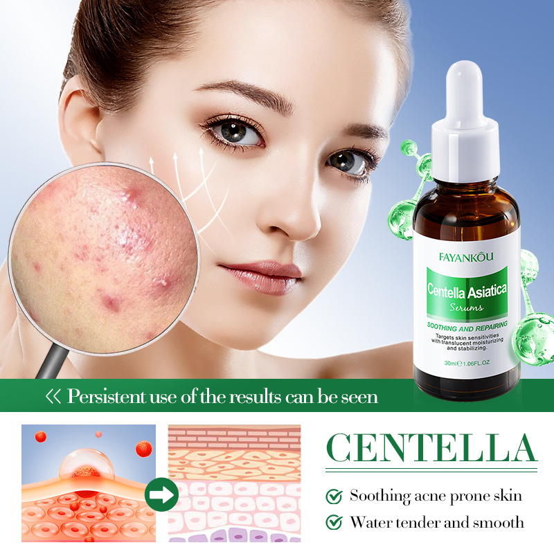 All-english FAYANKOU Centella asiatica Repair Essence, Hydrating and rejuvenating Essence, cross-border export wholesale Item Picture