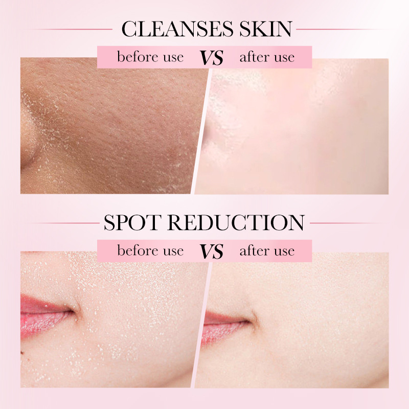 Cross-border export wholesale of all-English SADOER Four-in-one Facial multi-effect Cleansing Mousse Cleansing Foam Facial Cleanser Application Scenario