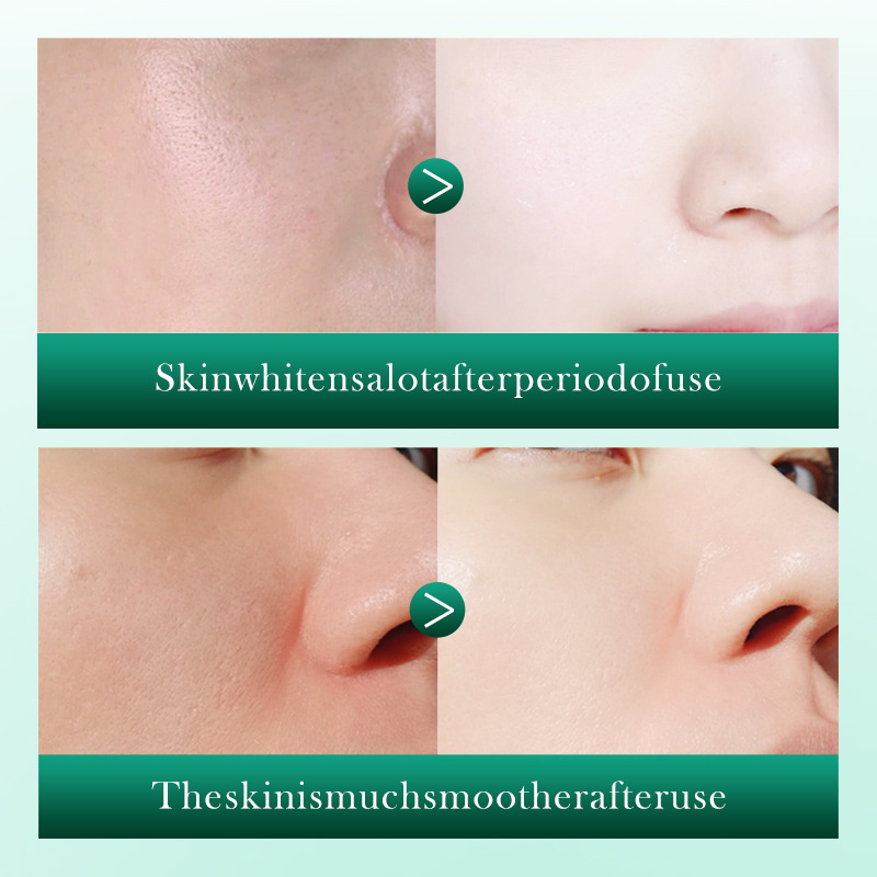 Cross-border wholesale of all-English SADOER Retinol Centella asiatica Anti-Wrinkle Soothing Essence and Hydrating Moisturizing Essence Application Scenario