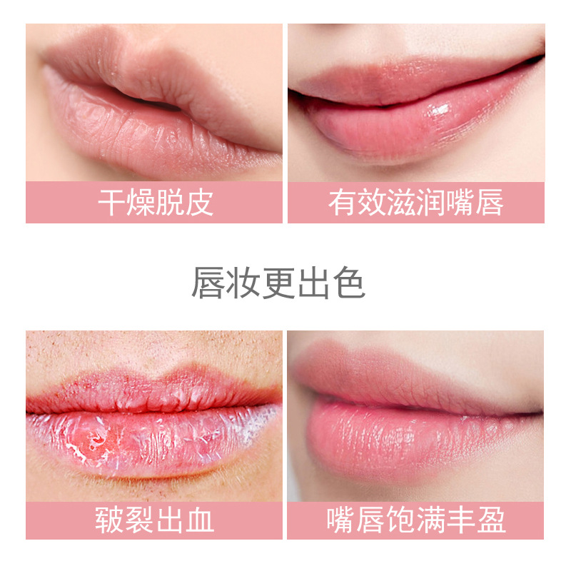 kissbeauty Peach Repairing Lip Balm, Hydrating Lip Balm, Moisturizing Lip Mask Wholesale Application Scenario