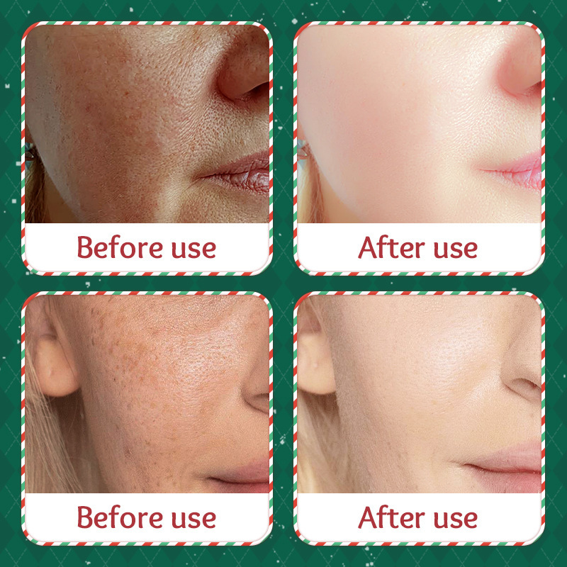 Cross-border wholesale of SADOER Christmas arbutin Whitening Facial mask and hydrating facial Mask in English Application Scenario
