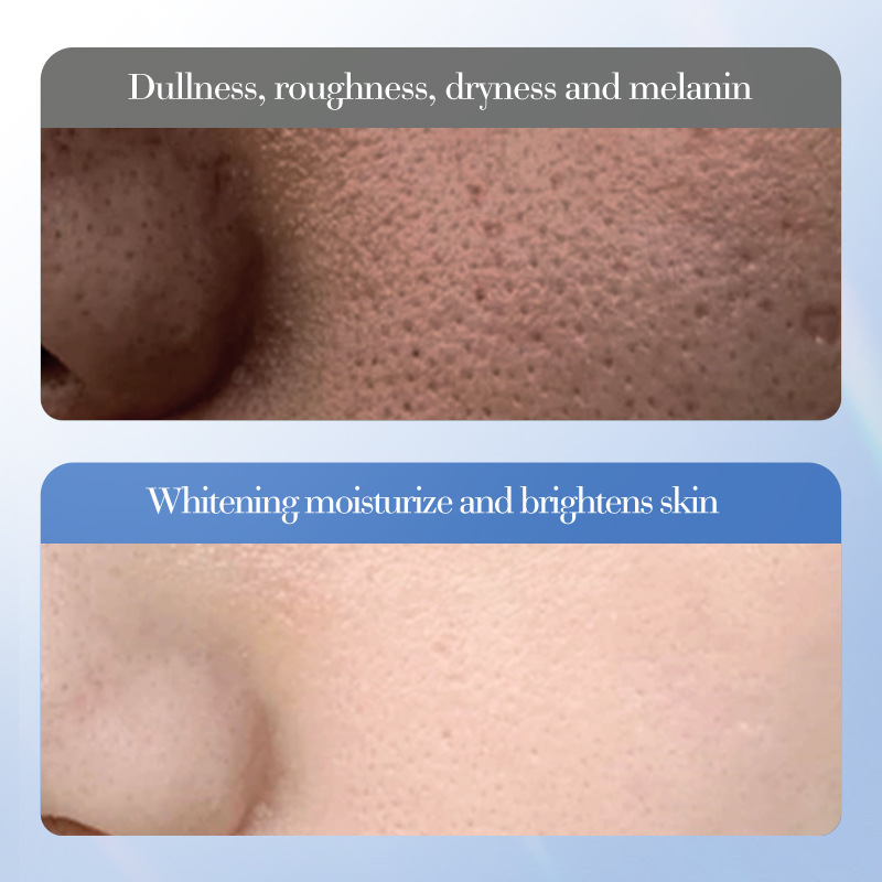 Cross-border export wholesale of SADOER White Rice Nicotinamide Brightening and Moisturizing Essence in full English Item Picture