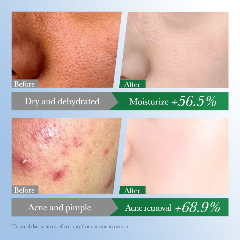 All-english FAYANKOU Centella asiatica Repair Essence, Hydrating and rejuvenating Essence, cross-border export wholesale Application Scenario