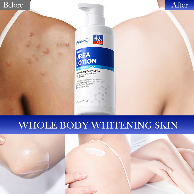 FAYANKOU Urea Moisturizing Body Lotion for autumn and winter cross-border export wholesale Item Picture